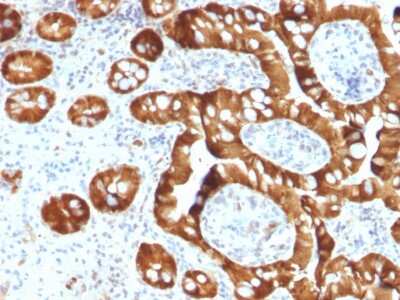Immunohistochemistry-Paraffin: Cytosolic Sulfotransferase 1E1/SULT1E1 Antibody (CPTC-SULT1E1-1) [NBP3-07324]