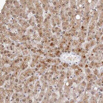 Immunohistochemistry-Paraffin: Cytosolic Sulfotransferase 1E1/SULT1E1 Antibody [NBP1-84785]