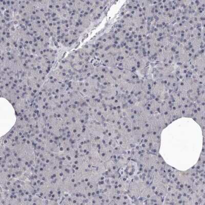 Immunohistochemistry-Paraffin: Cytosolic Sulfotransferase 1E1/SULT1E1 Antibody [NBP1-84786]