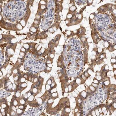 Immunohistochemistry-Paraffin: Cytosolic Sulfotransferase 1E1/SULT1E1 Antibody [NBP1-84786]