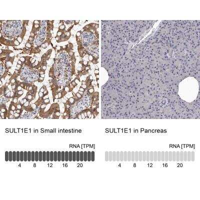 Immunohistochemistry-Paraffin: Cytosolic Sulfotransferase 1E1/SULT1E1 Antibody [NBP1-84786]