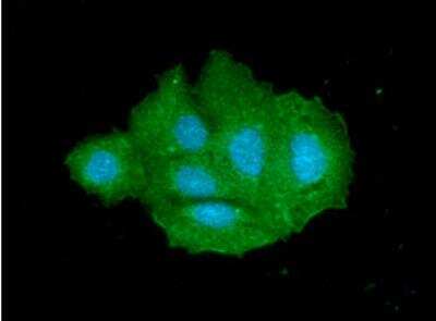 Immunocytochemistry/ Immunofluorescence: Cytosolic Sulfotransferase 2A1/SULT2A1 Antibody (AT13E10) - BSA Free [NBP2-61163]