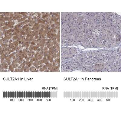 Immunohistochemistry-Paraffin: Cytosolic Sulfotransferase 2A1/SULT2A1 Antibody [NBP2-49402]