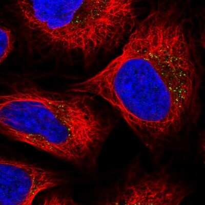Immunocytochemistry/ Immunofluorescence: Cytosolic Sulfotransferase 2B1/SULT2B1 Antibody [NBP2-32596]