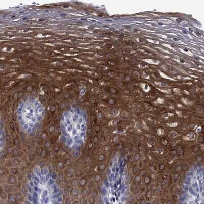Immunohistochemistry-Paraffin: Cytosolic Sulfotransferase 2B1/SULT2B1 Antibody [NBP3-16997]
