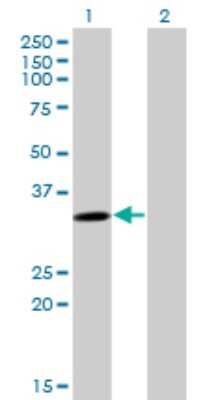 Western Blot: Cytosolic Sulfotransferase 4A1/SULT4A1 Antibody (3C1) [H00025830-M02]