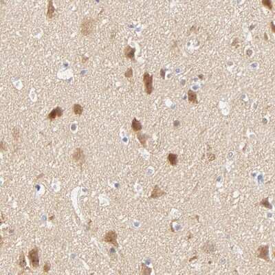 Immunohistochemistry-Paraffin: Cytosolic Sulfotransferase 4A1/SULT4A1 Antibody [NBP1-81770]