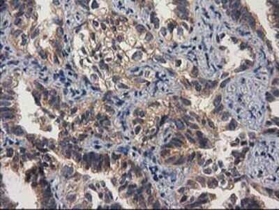 Immunohistochemistry: Cytosolic beta-Glucosidase/GBA3 Antibody (OTI1F1) - Azide and BSA Free [NBP2-72100]