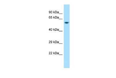 Western Blot: D2HGDH Antibody [NBP2-84755]