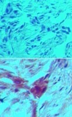Immunohistochemistry-Paraffin: D4-GDI/RhoGDI2 Antibody (97A1015) - (cleavage specific) - Azide Free [NBP2-33248]