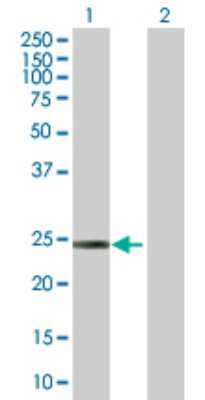 Western Blot: D4-GDI/RhoGDI2 Antibody [H00000397-B01P]