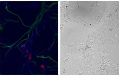 Immunocytochemistry/ Immunofluorescence: D4S234E Antibody [NBP2-26148]