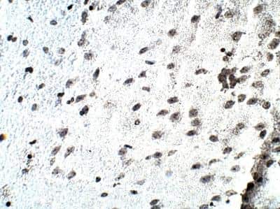 Immunohistochemistry-Paraffin: D4S234E Antibody [NBP3-12296]