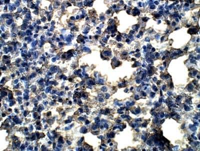 Immunohistochemistry-Paraffin: D4S234E Antibody [NBP3-12296]
