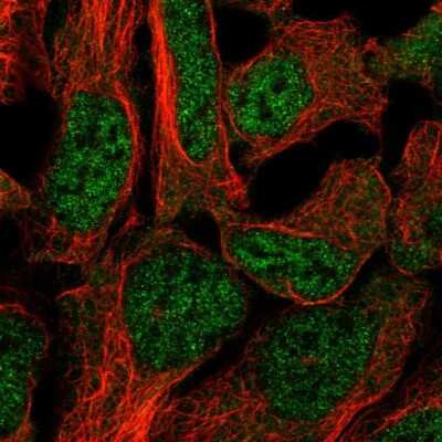 Immunocytochemistry/ Immunofluorescence: DAAM2 Antibody [NBP2-47496]