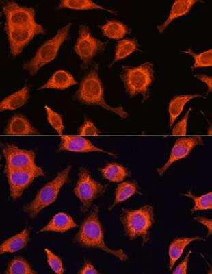 Immunocytochemistry/ Immunofluorescence: DAAM2 Antibody - BSA Free [NBP2-92809]