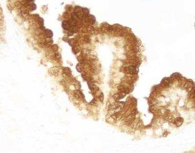 Immunohistochemistry-Paraffin: DAB/Ni Peroxidase Substrate Kit [SK-4100-NB]