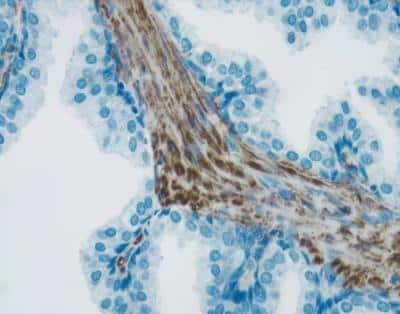 Immunohistochemistry: DAB/Ni Peroxidase Substrate Kit [SK-4100-NB]