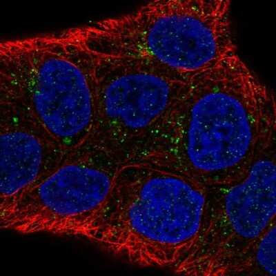 Immunocytochemistry/ Immunofluorescence: DAB1 Antibody [NBP2-38661]