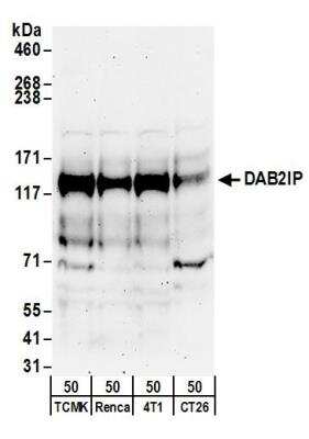 Western Blot: DAB2IP Antibody [NBP1-30081]