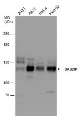 Western Blot: DAB2IP Antibody [NBP3-13027]