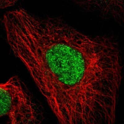 Immunocytochemistry/ Immunofluorescence: DACH1 Antibody [NBP1-85320]