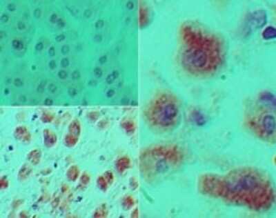 Immunohistochemistry-Paraffin: DACH1 Antibody [NBP2-27192]