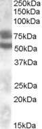 Western Blot: DACH1 Antibody [NBP1-00136]