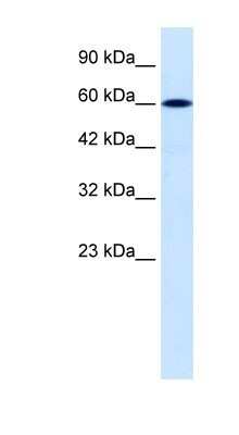Western Blot: DACH2 Antibody [NBP1-80001]
