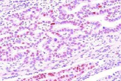Immunohistochemistry-Paraffin: DACT3/Dapper 3 Antibody (2A5) - BSA Free [NBP1-19052]