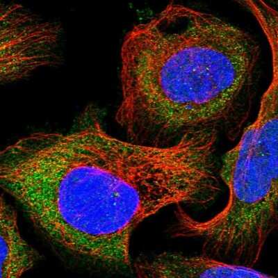 Immunocytochemistry/ Immunofluorescence: DAK Antibody [NBP1-84142]