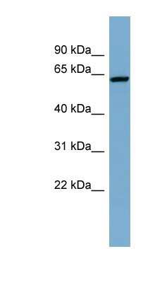 Western Blot: DAK Antibody [NBP1-54881]
