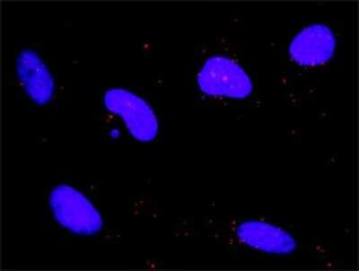 Proximity Ligation Assay: DAP Kinase 1 Antibody (2E7) [H00001612-M01]