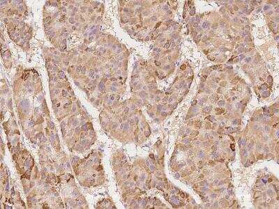 Immunohistochemistry-Paraffin: DAP Kinase 2 Antibody [NBP3-06183]