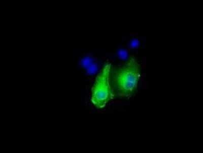Immunocytochemistry/ Immunofluorescence: DAP Kinase 2 Antibody (OTI1C5) - Azide and BSA Free [NBP2-71753]