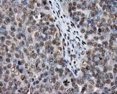 Immunohistochemistry: DAP Kinase 2 Antibody (OTI1C5) - Azide and BSA Free [NBP2-71753]