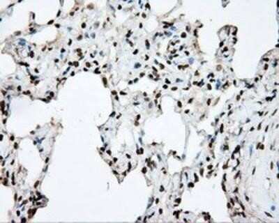 Immunohistochemistry: DAP Kinase 2 Antibody (OTI1C5) - Azide and BSA Free [NBP2-71753]