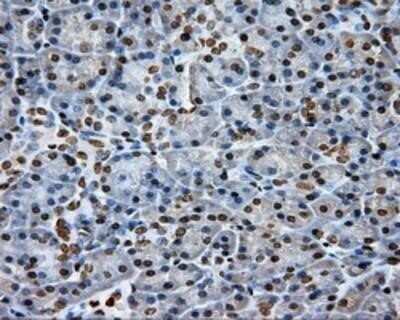 Immunohistochemistry: DAP Kinase 2 Antibody (OTI1C5) - Azide and BSA Free [NBP2-71753]