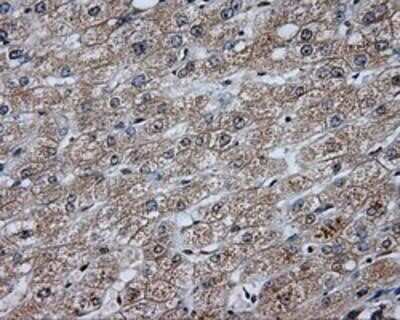Immunohistochemistry-Paraffin: DAP Kinase 2 Antibody (OTI1C5) [NBP2-02477]
