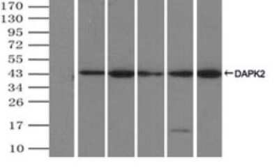 Immunoprecipitation: DAP Kinase 2 Antibody (OTI1C5) [NBP2-02477]