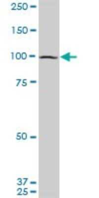 Western Blot: DAP5 Antibody (3B5) [H00001982-M01]