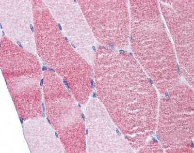 Immunohistochemistry-Paraffin: DAP5 Antibody [NBP1-31469]