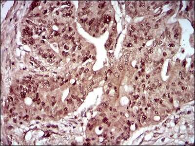 Immunohistochemistry: DAPK3/ZIPK Antibody (4H4C8) - BSA Free [NBP2-52452]