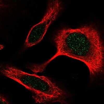 Immunocytochemistry/ Immunofluorescence: DAPK3/ZIPK Antibody [NBP2-57540]