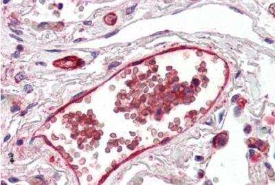 Immunohistochemistry-Paraffin: DARC Antibody [NB100-2421]
