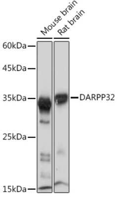 Western Blot: DARPP-32 Antibody (5T9G4) [NBP3-16316]
