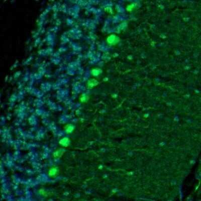 Immunohistochemistry: DARPP-32 Antibody [NBP2-33534]