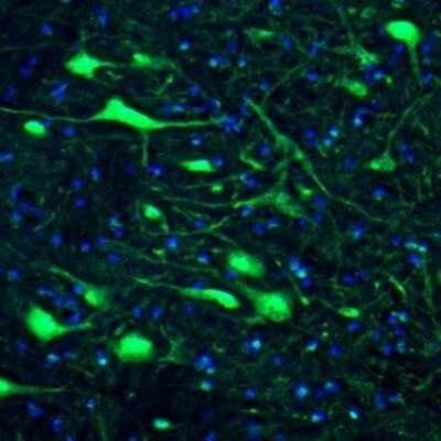 Immunohistochemistry: DARPP-32 Antibody [NBP2-33534]