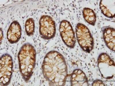 Immunohistochemistry-Paraffin: DARS Antibody (2F11) [H00001615-M01]