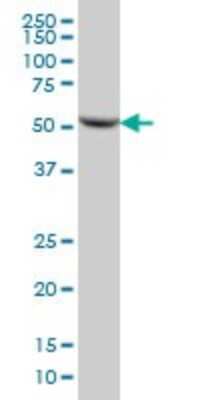 Western Blot: DARS Antibody (2F11) [H00001615-M01]